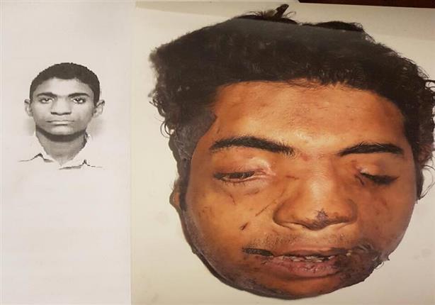 مصدر بالطب الشرعي يوضح: لماذا تم تفجير "البطرسية" بحزام ناسف وليس قنبلة؟ مصدر بالطب الشرعي يوضح: لماذا تم تفجير "البطرسية" بحزام ناسف وليس قنبلة؟