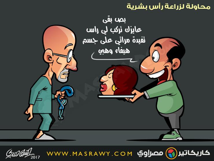 زراعة الرأس زراعة الرأس