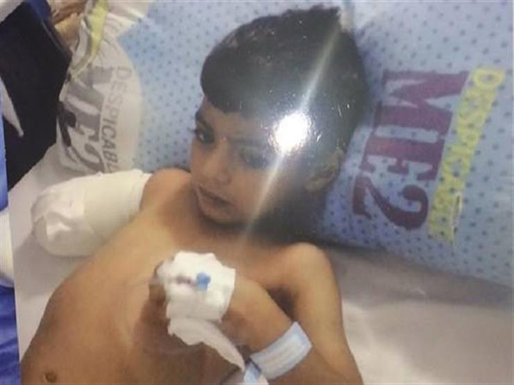 لإهمال تسبب في بتر ذراع طفل.. إحالة طبيب بالمنيا إلى النيابة لإهمال تسبب في بتر ذراع طفل.. إحالة طبيب بالمنيا إلى النيابة