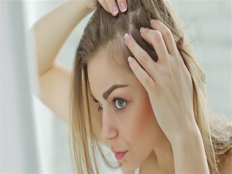 منها حبوب منع الحمل.. 9 عوامل تؤدي إلى إصابة المرأة بالصلع منها حبوب منع الحمل.. 9 عوامل تؤدي إلى إصابة المرأة بالصلع