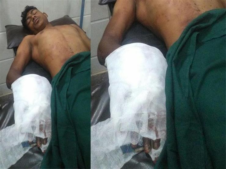 جزار هندي يقطع يد ابنه بسبب إدمانه الهاتف 2