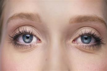 التهاب عصب العين2