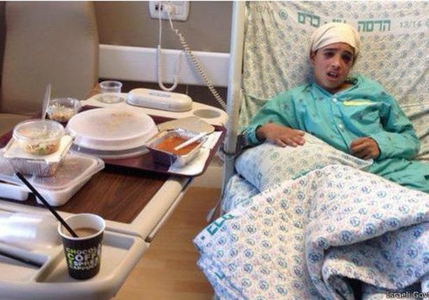 أحمد مناصرة مكبلا في أحد المستشفيات الاسرائيلية