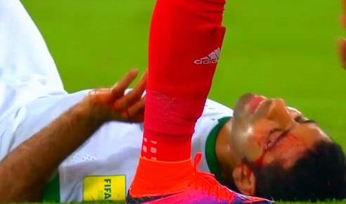 إصابة دموية لنجم المنتخب السعودي (1)