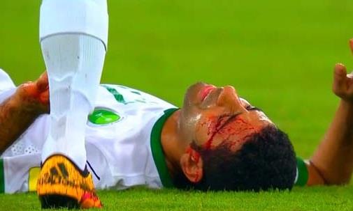 إصابة دموية لنجم المنتخب السعودي (3)