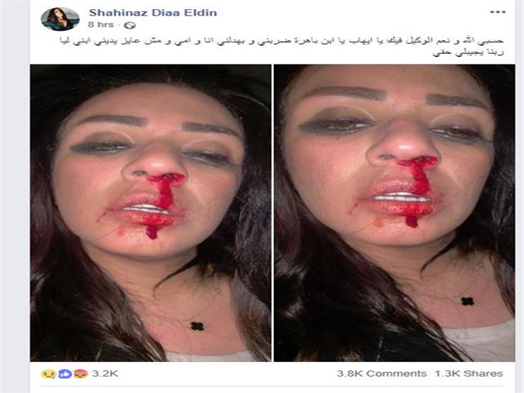 نجمة ستار أكاديمي تتهم زوجها بالاعتداء عليها بالضرب (3)