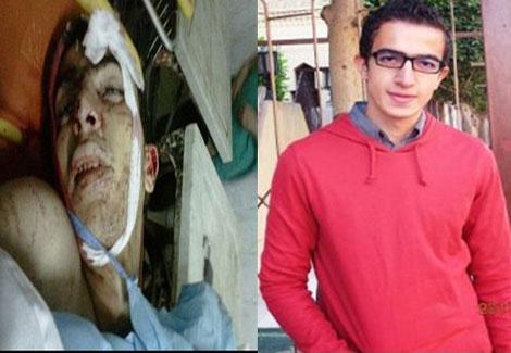 علاء عبدالهادي.. قصاص غائب لطبيب ثائر علاء عبدالهادي.. قصاص غائب لطبيب ثائر