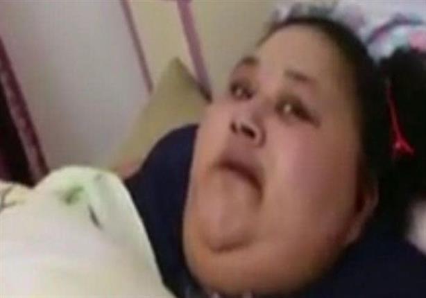 جراح هندي يجري جراحة لإنقاص وزن مصرية تزن 500 كيلوغرام جراح هندي يجري جراحة لإنقاص وزن مصرية تزن 500 كيلوغرام