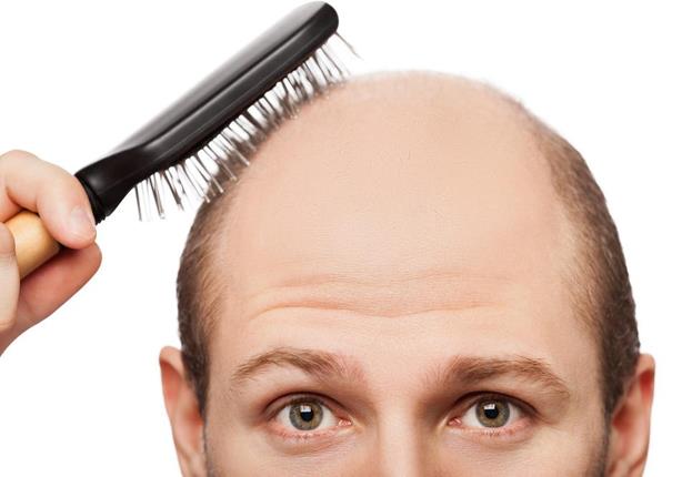 للرجل.. 5 عادات يومية تدمر شعرك للرجل.. 5 عادات يومية تدمر شعرك