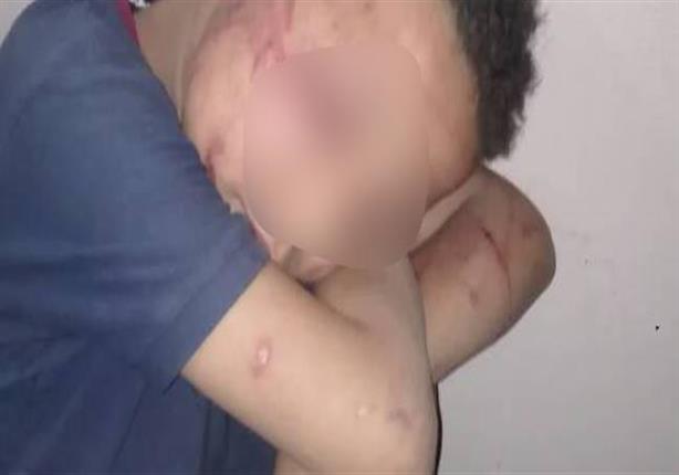ضبط زوجة الأب في واقعة تعذيب طفل حتى الموت بالشرقية ضبط زوجة الأب في واقعة تعذيب طفل حتى الموت بالشرقية