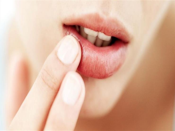 في الشتاء.. أفضل الطرق الطبيعية لعلاج تشققات شفتيكِ في الشتاء.. أفضل الطرق الطبيعية لعلاج تشققات شفتيكِ