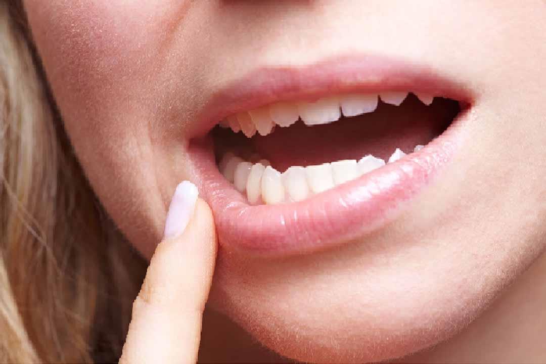 فوائد عديدة لـ"مساج اللثة".. بينها حماية الأسنان من التساقط فوائد عديدة لـ"مساج اللثة".. بينها حماية الأسنان من التساقط