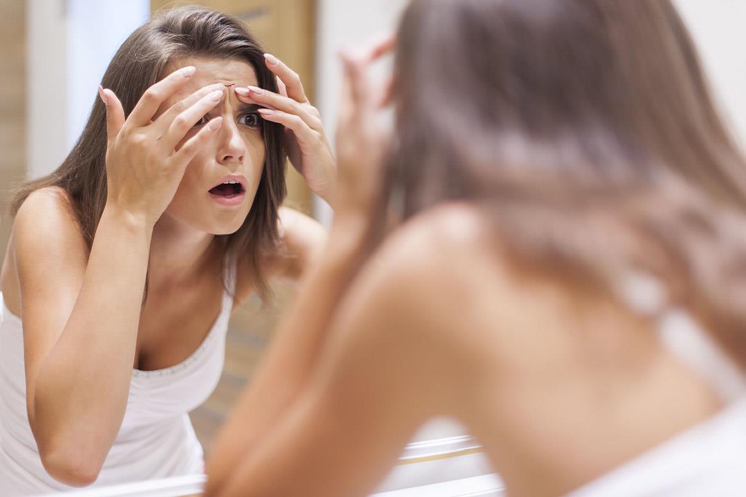 6 طرق طبيعية تخلصك من حبوب الجبهة 6 طرق طبيعية تخلصك من حبوب الجبهة