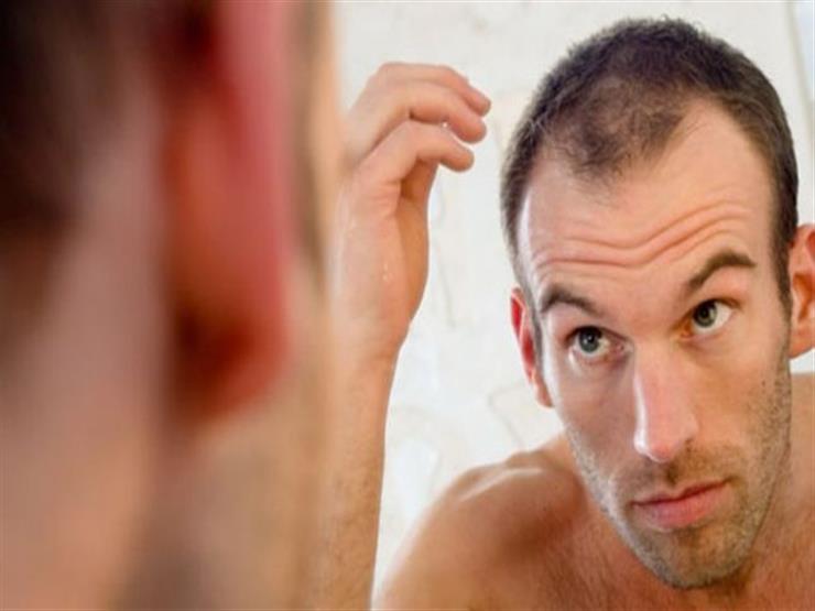 خبيرة تجميل توضح علاج لمشكلة الصلع المُبكر بالنخاع خبيرة تجميل توضح علاج لمشكلة الصلع المُبكر بالنخاع