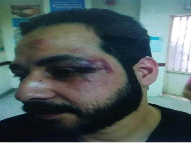 تفاصيل الاعتداء على طبيبين بمستشفى الساحل التعليمي: "كسروا أنف أحدهما" تفاصيل الاعتداء على طبيبين بمستشفى الساحل التعليمي: "كسروا أنف أحدهما"