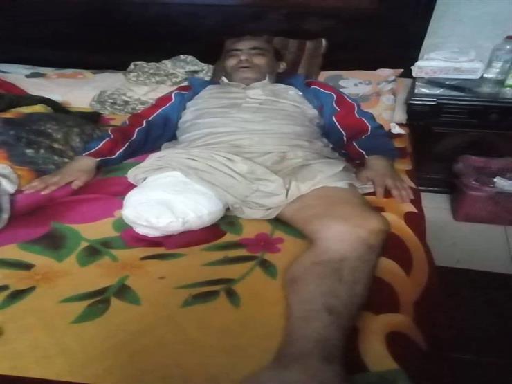 "دخل على رجله خرج عاجز".. بلاغ يتهم مستشفى بالتسبب في بتر قدم مريض (صورة) "دخل على رجله خرج عاجز".. بلاغ يتهم مستشفى بالتسبب في بتر قدم مريض (صورة)