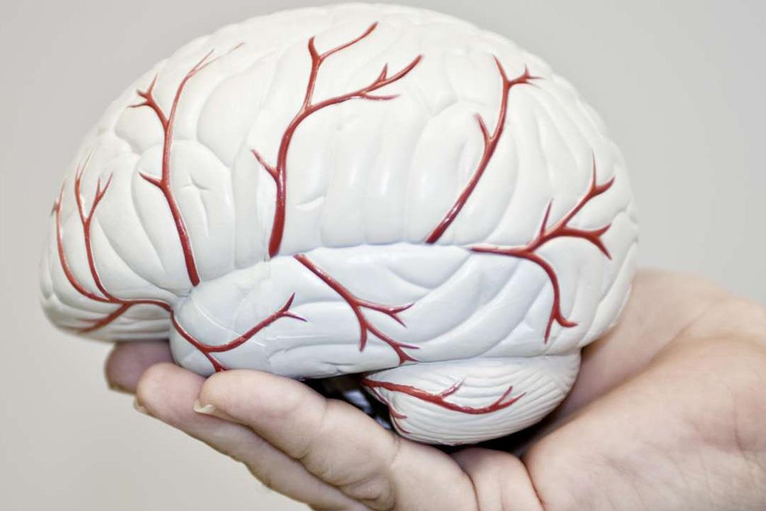 مضاعفات خطيرة لتشوه شرايين المخ.. هكذا نكتشفه مضاعفات خطيرة لتشوه شرايين المخ.. هكذا نكتشفه