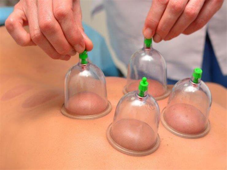 بالفيديو| أستاذ فقه يوضح حكم التداوي بالرقية الشرعية أو الحجامة بالفيديو| أستاذ فقه يوضح حكم التداوي بالرقية الشرعية أو الحجامة