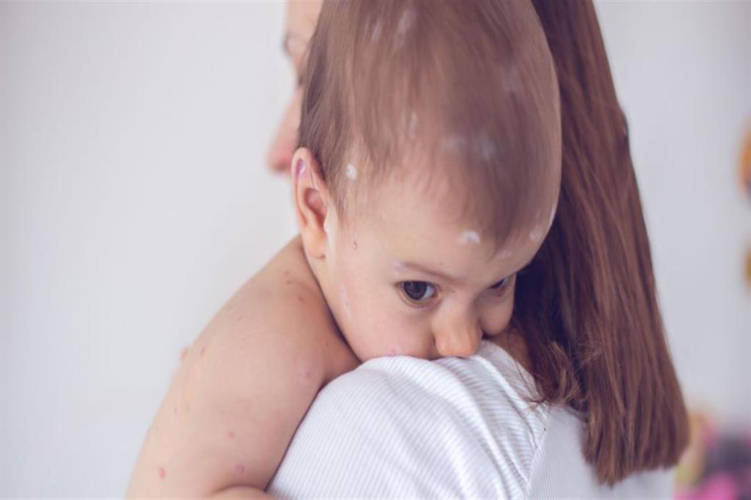 بالأسماء والأسعار| إليك أشهر أدوية الحساسية للكبار والأطفال بالأسماء والأسعار| إليك أشهر أدوية الحساسية للكبار والأطفال