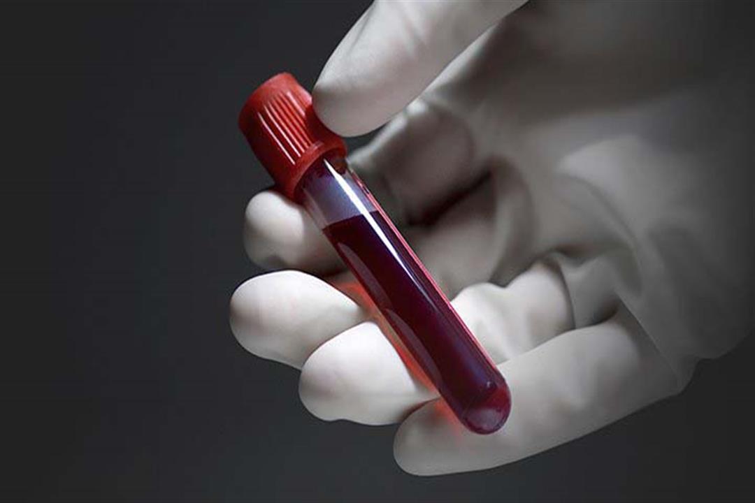 الدم الذهبي.. ماذا تعرف عن فصيلة الدم الأكثر ندرة في العالم؟