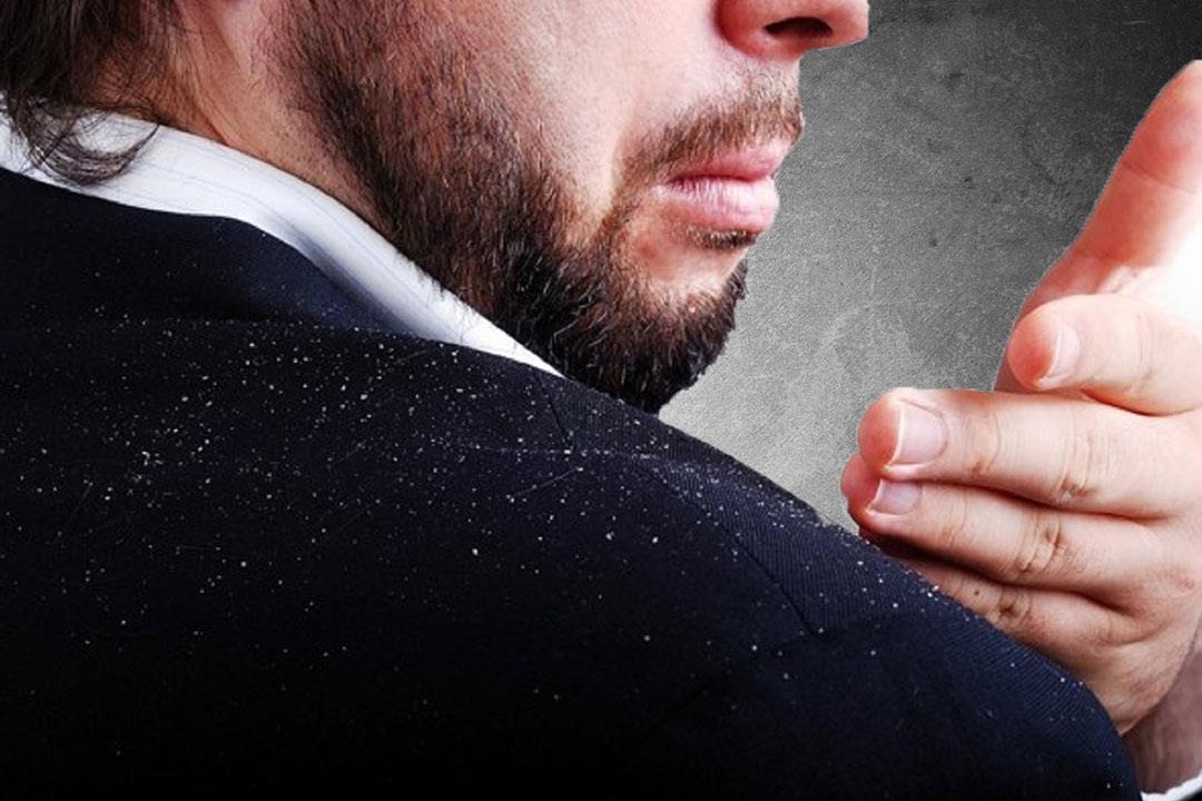 قشرة الشعر تزعجك؟.. 3 علاجات فعالة للقضاء عليها قشرة الشعر تزعجك؟.. 3 علاجات فعالة للقضاء عليها