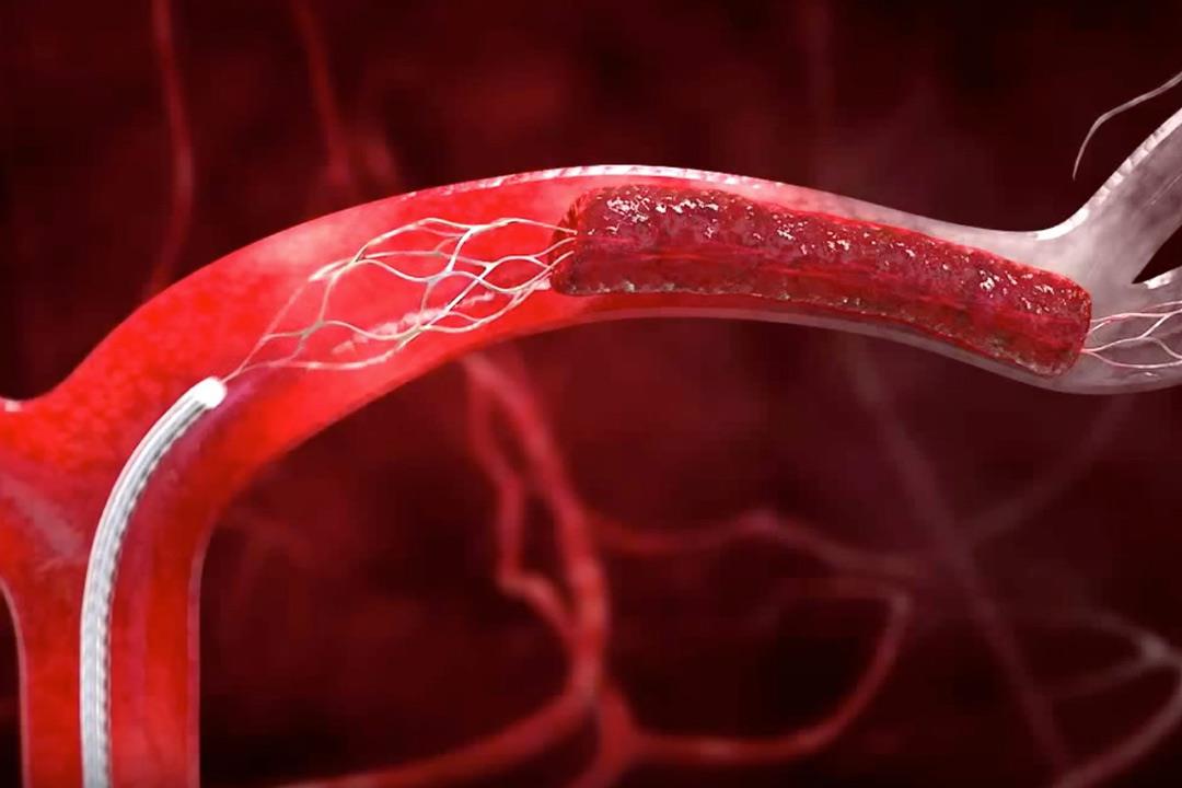 FDA توافق على علاج جديد لاضطراب تجلط الدم FDA توافق على علاج جديد لاضطراب تجلط الدم