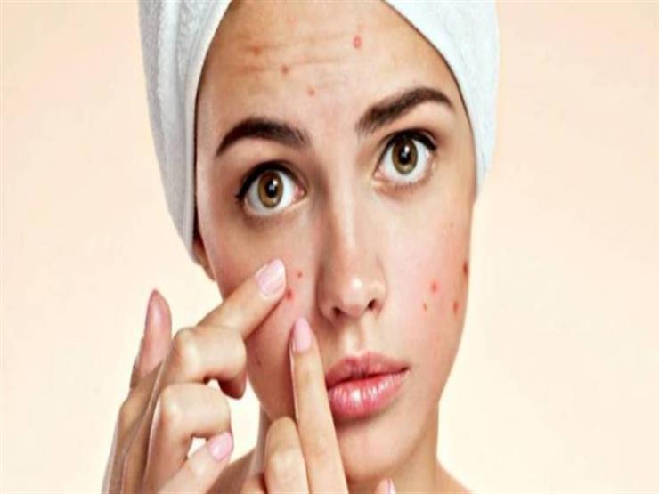 حاربي البثور بهذه الماسكات حاربي البثور بهذه الماسكات