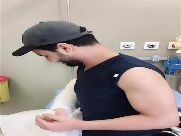 صورة| هكذا سخر أحمد جمال من كسر ذراعه صورة| هكذا سخر أحمد جمال من كسر ذراعه