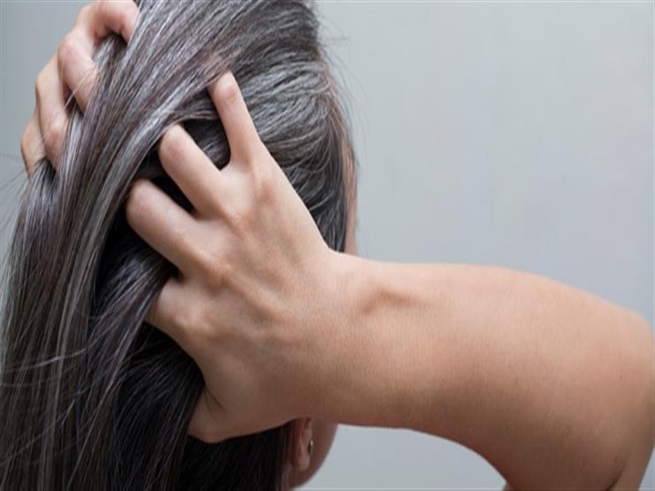 4 أسباب للشيب المبكر 4 أسباب للشيب المبكر