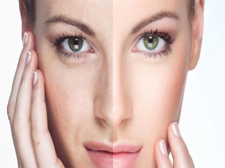 طرق استخدام مستحضرات الرتينوئيدات لعلاج جميع مشاكل البشرة طرق استخدام مستحضرات الرتينوئيدات لعلاج جميع مشاكل البشرة