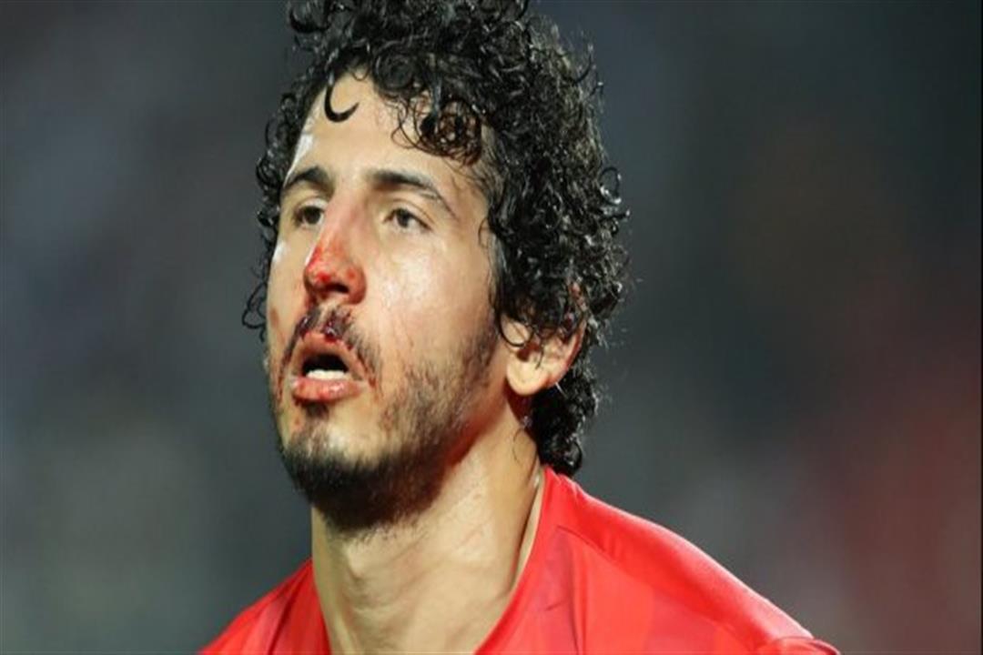طبيب المنتخب: حجازي يرتدي واقي للأنف.. وجميع اللاعبين جاهزين للكونغو طبيب المنتخب: حجازي يرتدي واقي للأنف.. وجميع اللاعبين جاهزين للكونغو