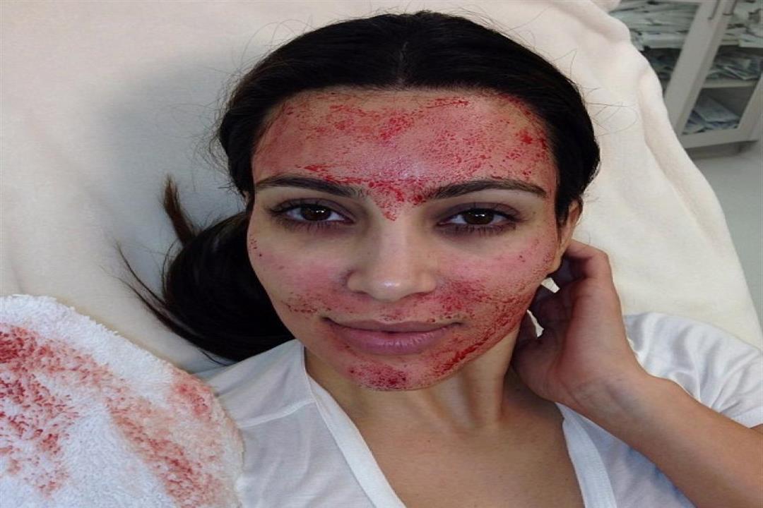 بسبب الإيدز.. ولاية أمريكية تحذر من استعمال قناع "كيم كارداشيان" في التجميل بسبب الإيدز.. ولاية أمريكية تحذر من استعمال قناع "كيم كارداشيان" في التجميل
