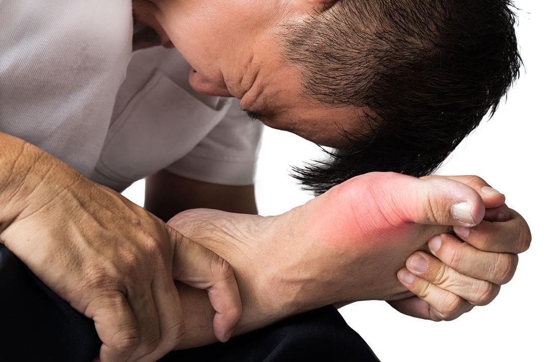 لمرضى النقرس.. دليلك لتناول اللحوم الحمراء بأمان في العيد لمرضى النقرس.. دليلك لتناول اللحوم الحمراء بأمان في العيد