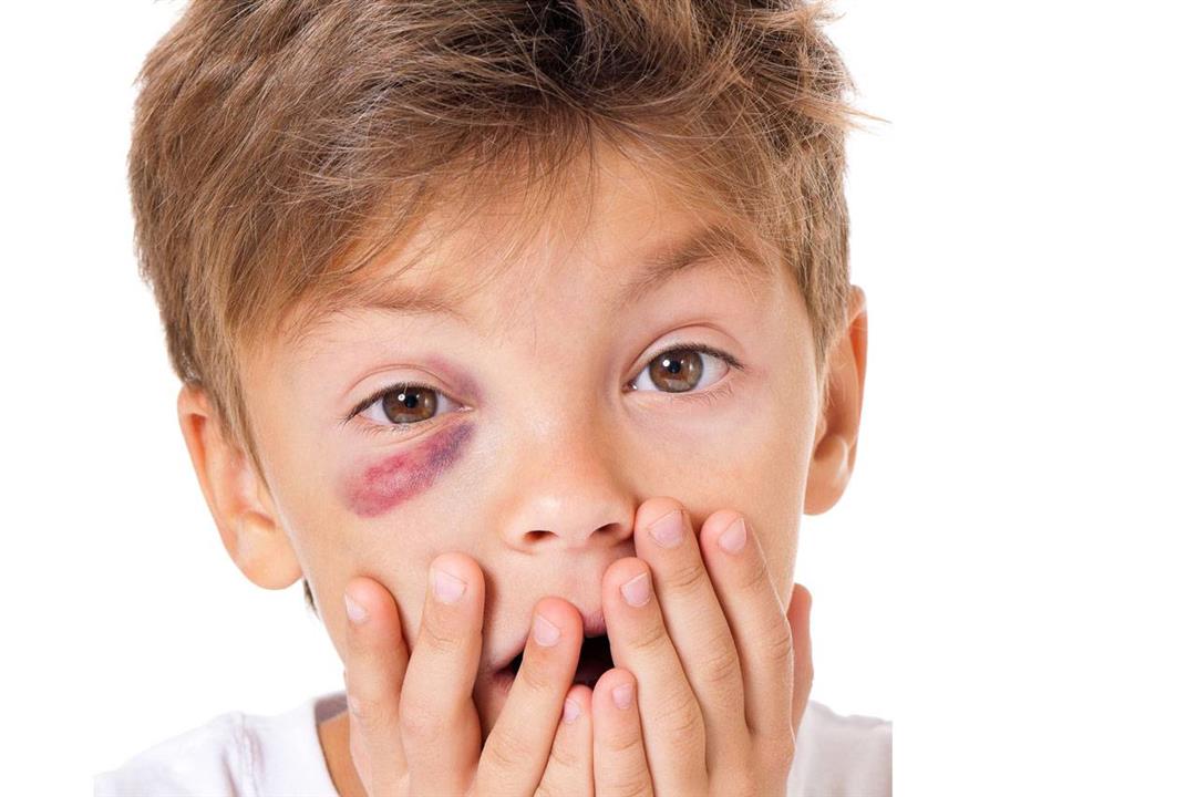 ماذا يحدث لعينك عند تلقي لكمة في الوجه؟ ماذا يحدث لعينك عند تلقي لكمة في الوجه؟