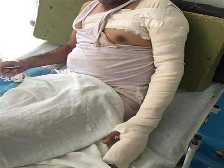 "عشان ميعملش راجل".. ابنة محامي الشرقية تروي قصة إشعال بلطجية النار في جسده "عشان ميعملش راجل".. ابنة محامي الشرقية تروي قصة إشعال بلطجية النار في جسده