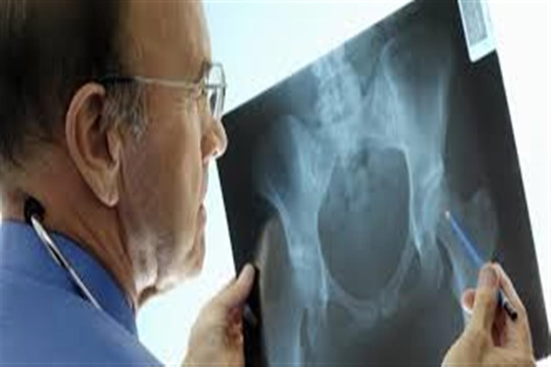 FDA توافق على أول علاج لتورم الخلايا العملاقة في العظام FDA توافق على أول علاج لتورم الخلايا العملاقة في العظام
