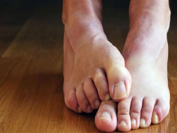 ينذر بقصور الكلى واعتلال الأعصاب.. هل تشعر بألم في باطن القدم؟ ينذر بقصور الكلى واعتلال الأعصاب.. هل تشعر بألم في باطن القدم؟