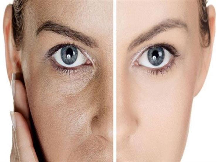 بـ 7 حيل تخلصي من مسام بشرتك الواسعة بـ 7 حيل تخلصي من مسام بشرتك الواسعة