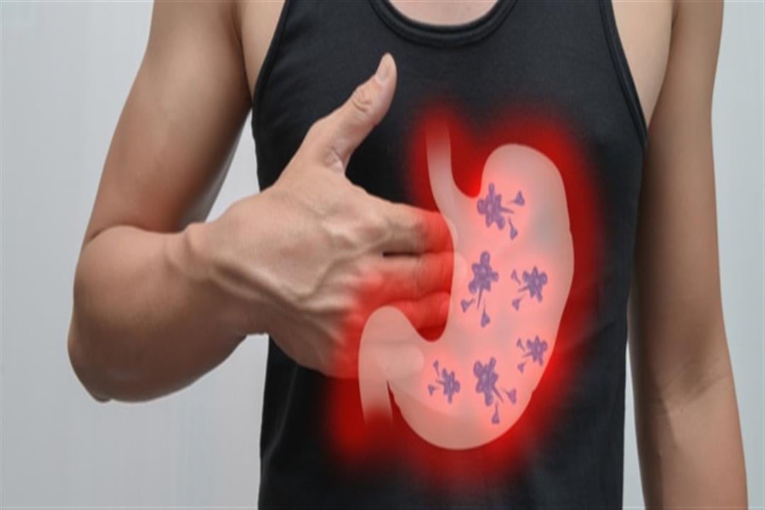لمرضى جرثومة المعدة.. إليكم قائمة بالأطعمة الممنوعة لمرضى جرثومة المعدة.. إليكم قائمة بالأطعمة الممنوعة