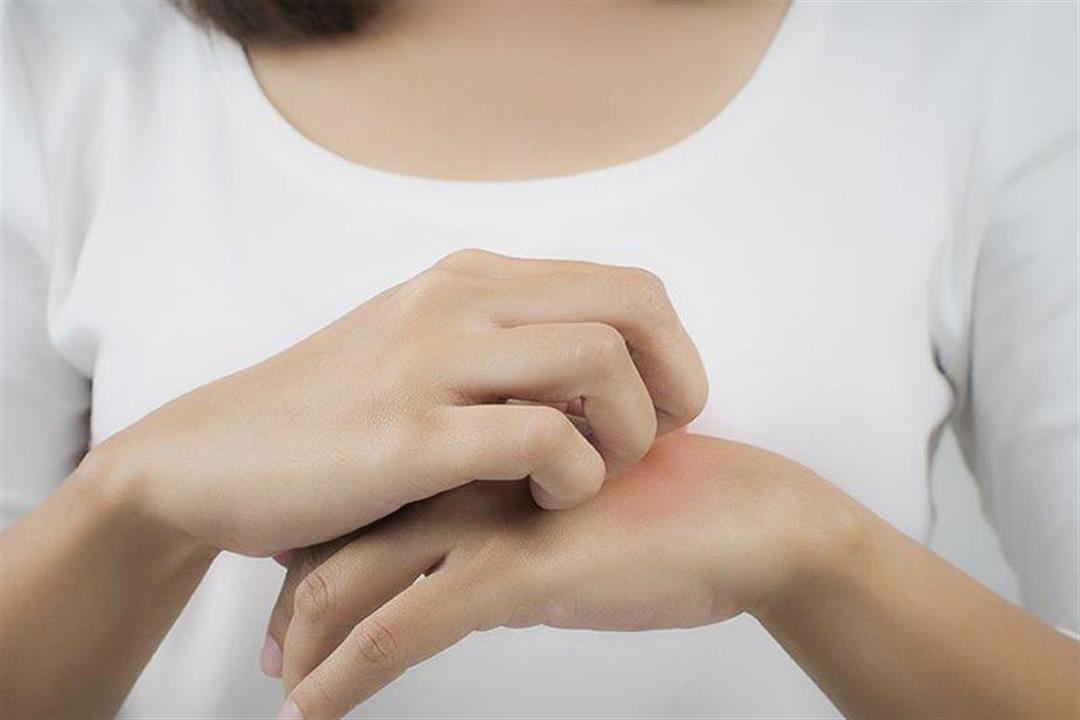 تصيبهم بالأكزيما الغذائية.. 8 مأكولات محظورة على مرضى حساسية الطعام تصيبهم بالأكزيما الغذائية.. 8 مأكولات محظورة على مرضى حساسية الطعام