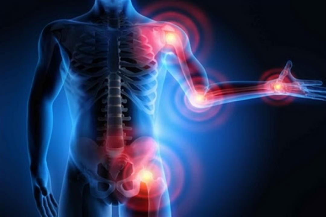 6 أنواع مختلفة لالتهابات المفاصل.. إليك طرق العلاج 6 أنواع مختلفة لالتهابات المفاصل.. إليك طرق العلاج