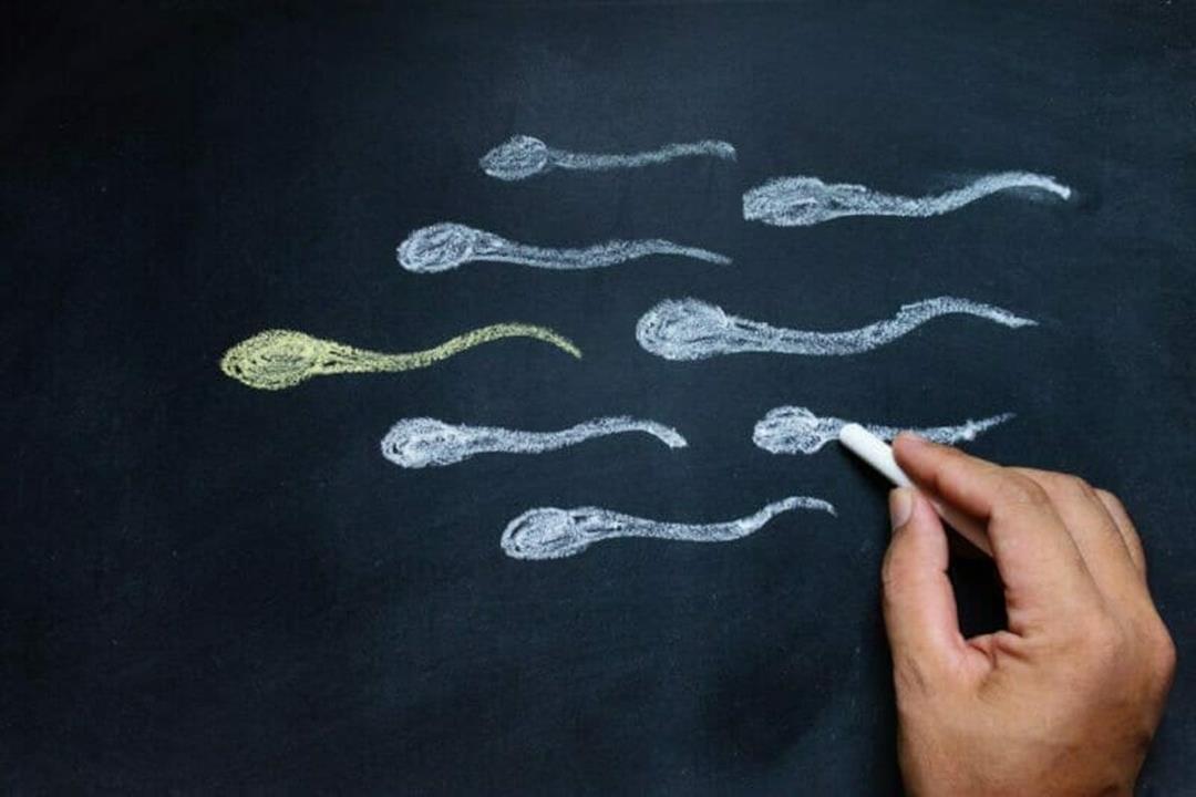 مرض خلقي أم مكتسب؟.. إليك كل ما تريد معرفته عن تشوه الحيوانات المنوية مرض خلقي أم مكتسب؟.. إليك كل ما تريد معرفته عن تشوه الحيوانات المنوية
