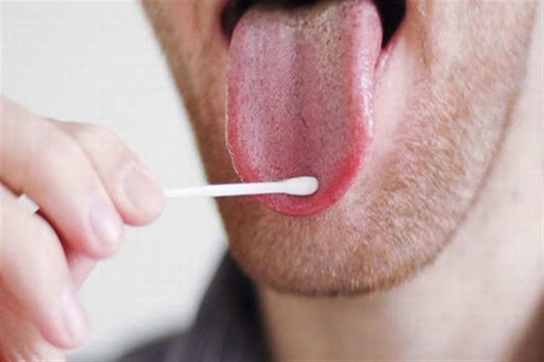 مضاعفاتها خطيرة.. طرق علاج المشكلات الصحية المسببة لاحمرار اللسان مضاعفاتها خطيرة.. طرق علاج المشكلات الصحية المسببة لاحمرار اللسان