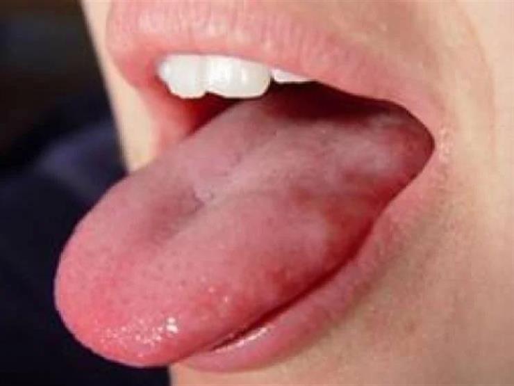 7 حقائق لا تعرفها عن لسانك.. لا يتعب ولونه يدل على صحتك 7 حقائق لا تعرفها عن لسانك.. لا يتعب ولونه يدل على صحتك