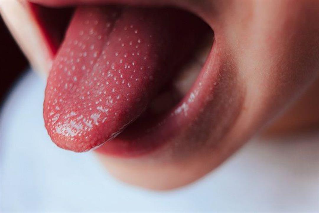 "الصحة العالمية": هناك ارتباط بين إصابة الأطفال بكورونا وكاواساكى "الصحة العالمية": هناك ارتباط بين إصابة الأطفال بكورونا وكاواساكى