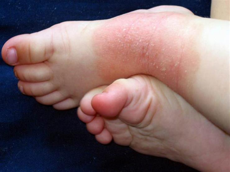 What Causes Pain In Your Feet And Ankles